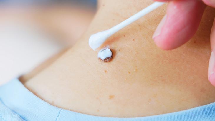 lazer de yaptiran da var solusyon suren de her ben masum degil incelenmeli DWSgtROZ.jpg